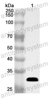 Anti-Human CHKA Polyclonal Antibody