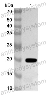 Anti-Human KRT2 Polyclonal Antibody