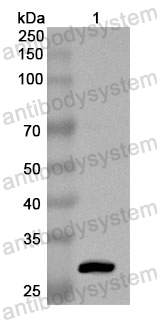 Anti-Human DLST/OGDC-E2 Polyclonal Antibody