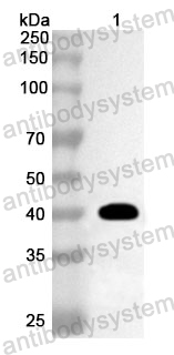 Anti-Human DLST/OGDC-E2 Polyclonal Antibody