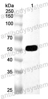 Anti-Human CSK Polyclonal Antibody