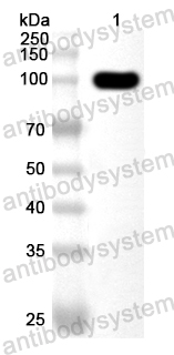 Anti-IARS1 Polyclonal Antibody