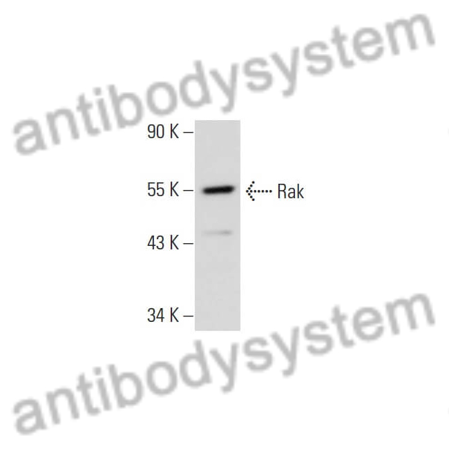 Anti-FRK Polyclonal Antibody