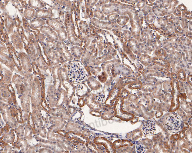 Immunohistochemical for Anti-Human SSR1 Polyclonal Antibody ?>