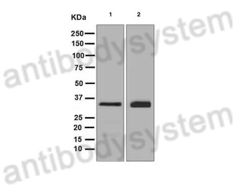 Western Blot for Anti-Human SSR1 Polyclonal Antibody ?>