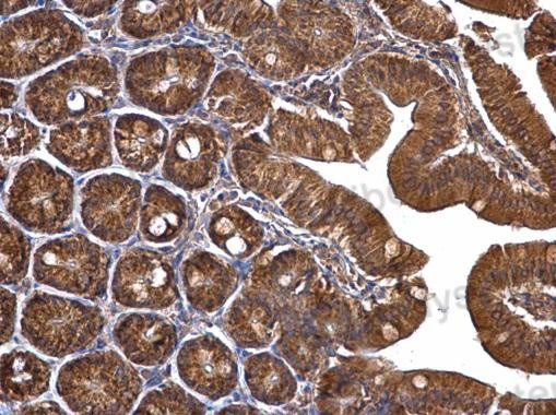 Immunohistochemical for Anti-Human TUFM Polyclonal Antibody ?>