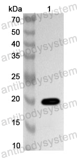 Anti-DIO1 Polyclonal Antibody 
