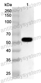 Anti-Human CCT4 Polyclonal Antibody