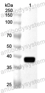 Anti-Human CAV2 Polyclonal Antibody