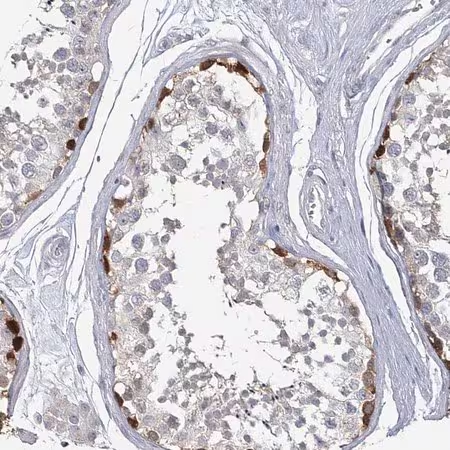 Immunohistochemical for Anti-Human USP11 Polyclonal Antibody ?>