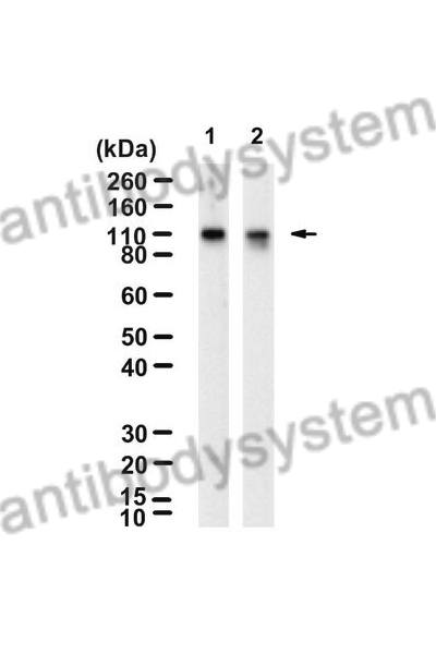 Western Blot for Anti-Human USP11 Polyclonal Antibody ?>