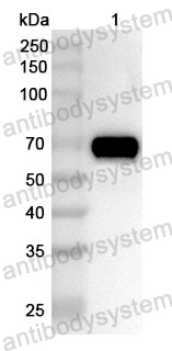 Anti-Human ACLY Polyclonal Antibody