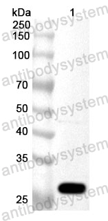Anti-Human SLC12A2 Polyclonal Antibody