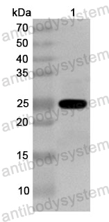 Anti-Human AQP4/Aquaporin-4 Polyclonal Antibody
