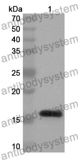 Anti-MAP3K7CL Polyclonal Antibody