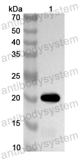 Anti-Human DEFB1 Polyclonal Antibody