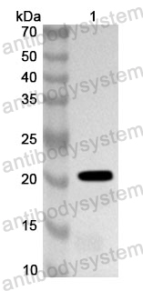 Anti-Human RAN Polyclonal Antibody