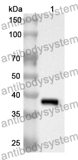Anti-Human PPP2CA Polyclonal Antibody