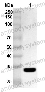 Anti-Human SLC6A3 Polyclonal Antibody