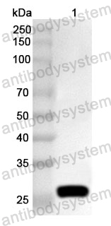 Anti-Human GUCY1A1 Polyclonal Antibody