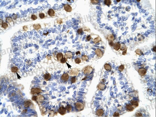 Immunohistochemical for Anti-Human YWHAH Polyclonal Antibody ?>