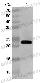 Anti-Human EXOSC9 Polyclonal Antibody