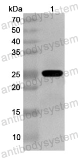 Anti-Human TRIM32 Polyclonal Antibody