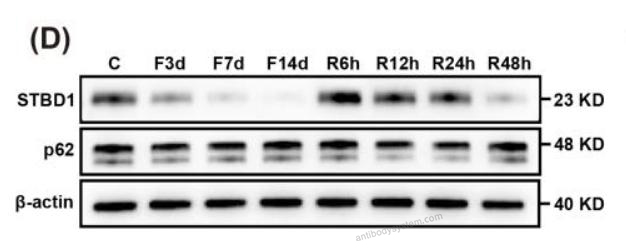 Western Blot for Anti-SQSTM1/p62 Polyclonal Antibody ?>