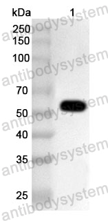 Anti-Human NEUROD1 Polyclonal Antibody