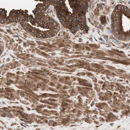 Immunohistochemical for Anti-Human PRKG1 Polyclonal Antibody ?>