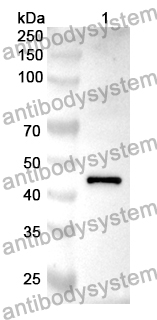 Anti-CAMK1 Polyclonal Antibody