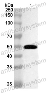 Anti-Human FGL2 Polyclonal Antibody