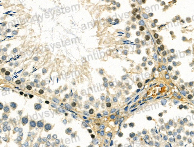 Immunohistochemical for Anti-Human DMC1 Polyclonal Antibody ?>