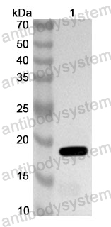Anti-Human LASP1 Polyclonal Antibody