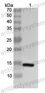 Anti-Human RAB3GAP1 Polyclonal Antibody