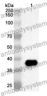 Anti-Human PDK2 Polyclonal Antibody