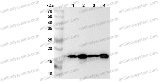 Anti-Human TOMM20 Polyclonal Antibody
