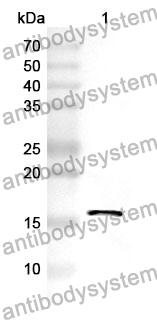 Anti-ANGPT1 Polyclonal Antibody