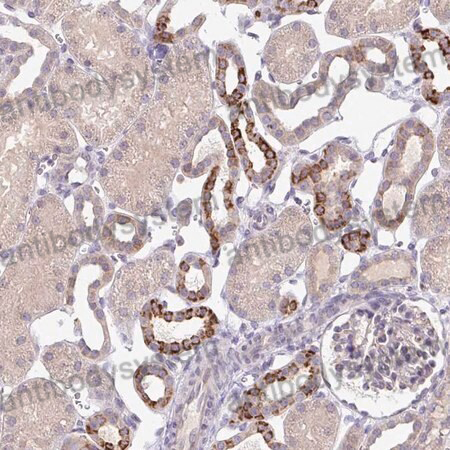 Immunohistochemical for Anti-Human SKIV2L Polyclonal Antibody ?>