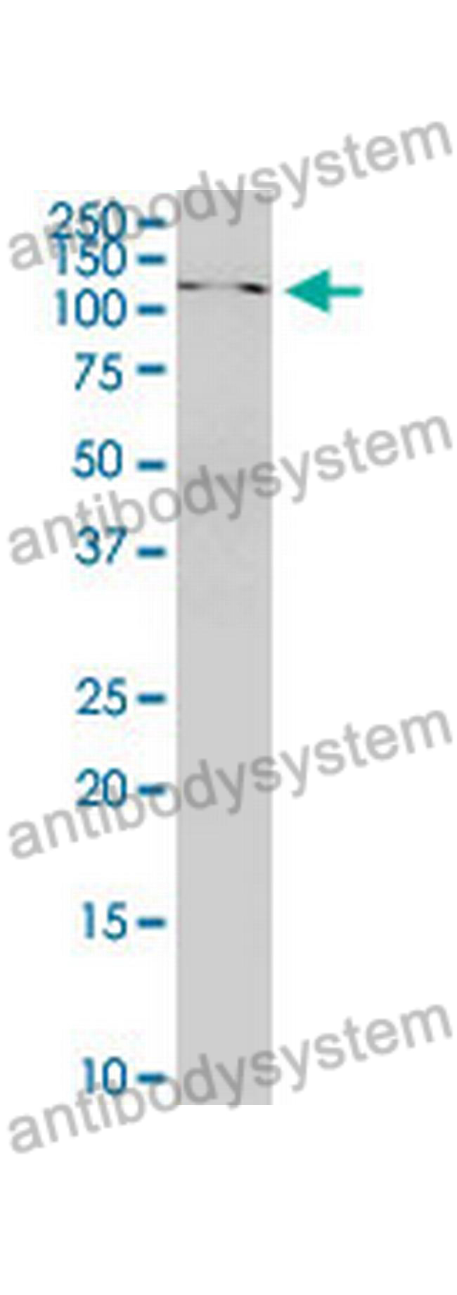 Western Blot for Anti-Human SKIV2L Polyclonal Antibody ?>
