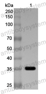 Anti-TERF2 Polyclonal Antibody