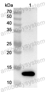 Anti-Human ELF2 Polyclonal Antibody