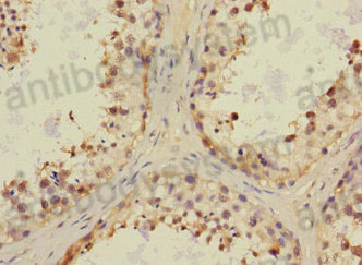 Immunohistochemical for Anti-Human CHRNA6 Polyclonal Antibody ?>