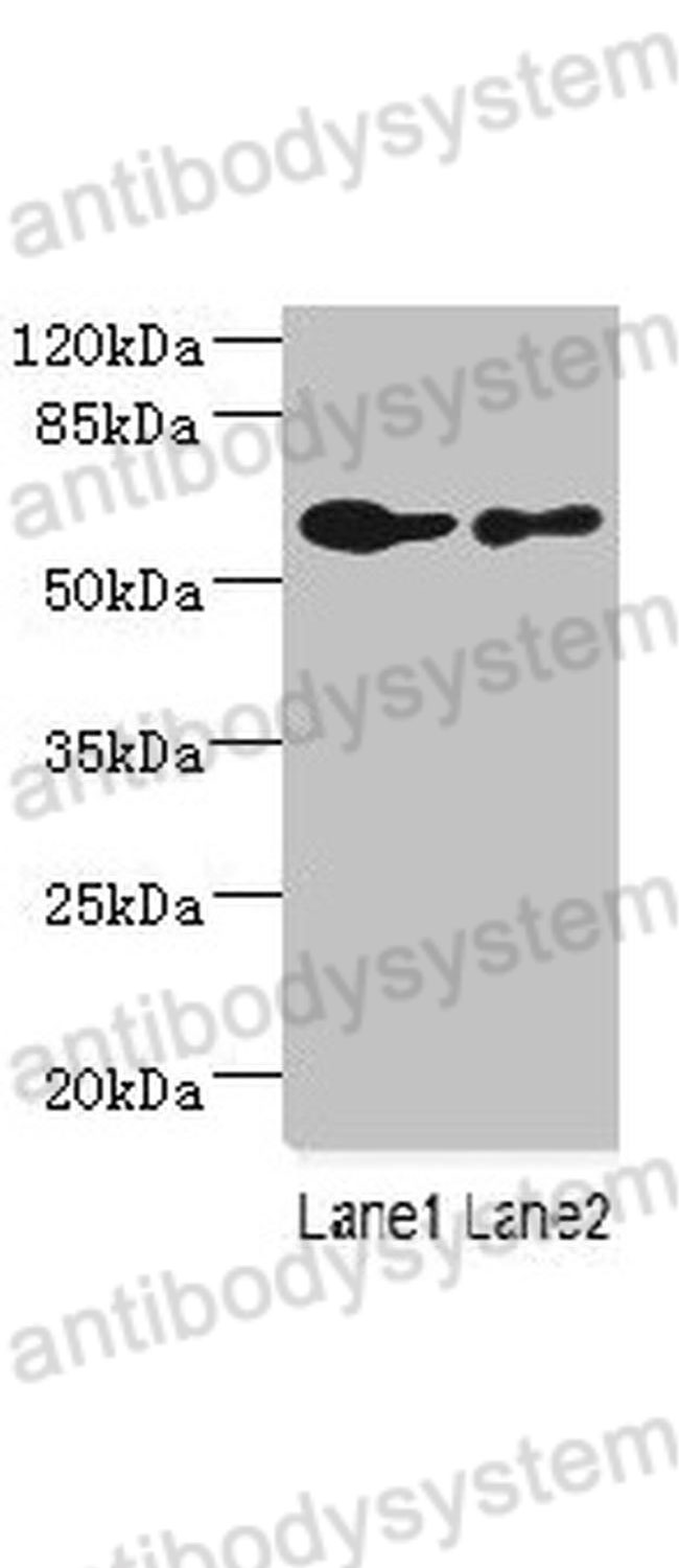 Western Blot for Anti-Human CHRNA6 Polyclonal Antibody ?>