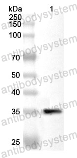 Anti-HIF1A Polyclonal Antibody