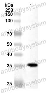 Anti-Human INF2 Polyclonal Antibody