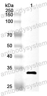 Anti-Human ACSM3 Polyclonal Antibody
