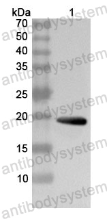 Anti-Human HSD17B12 Polyclonal Antibody