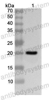 Anti-Human CCDC80 Polyclonal Antibody