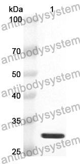 Buy AntiCNTN4 Polyclonal antibody